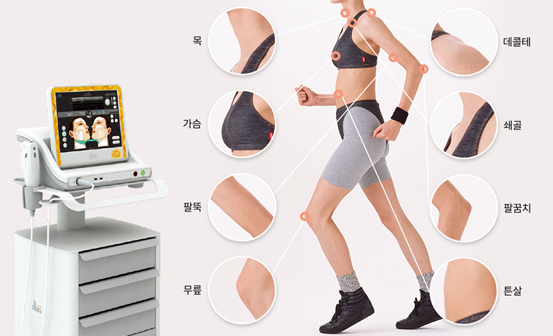 목, 데콜테, 쇄골, 가슴, 팔뚝, 팔꿈치, 튼살, 무릎