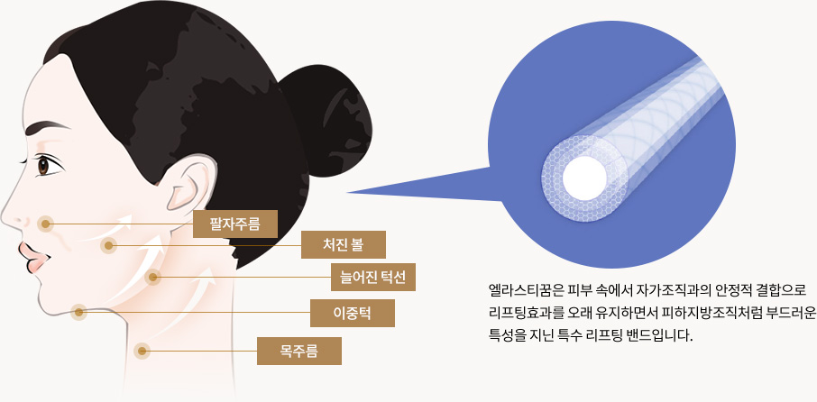 엘라스티꿈은 피부 속에서 자가조직과의 안정적 결합으로 리프팅효과를 오래 유지하면서 피하지방조직처럼 부드러운 특성을 지닌 특수 리프팅 밴드입니다.