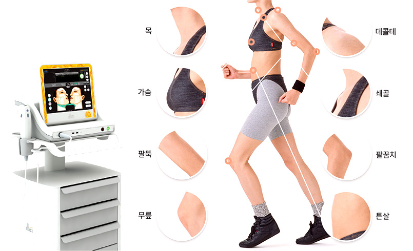 목, 데콜테, 쇄골, 가슴, 팔뚝, 팔꿈치, 튼살, 무릎