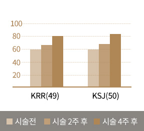 시술전 / 시술 2후 후 / 시술 4주 후 비교 차트 이미지