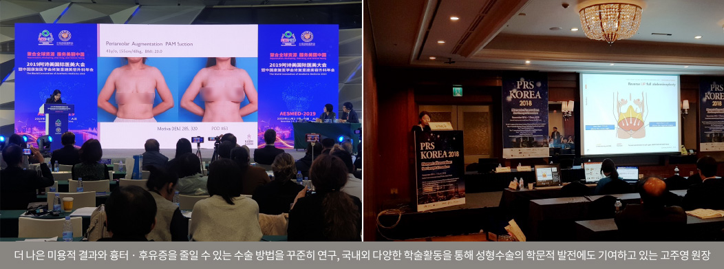 持續研究能獲得更好的美容效果並減少疤痕、後遺症的手術方法，透過國內外各種學術活動為整形手術的學術發展做出貢獻的高周英院長